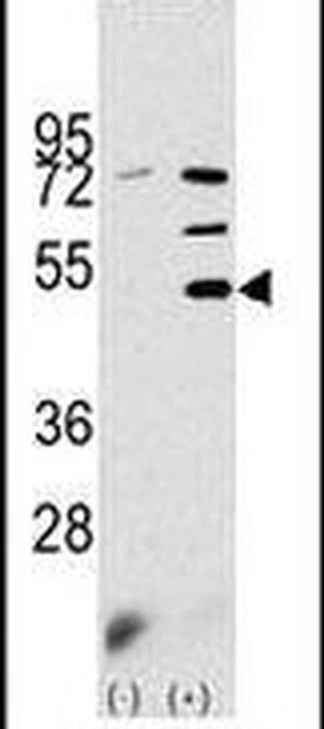 PDK3 Antibody in Western Blot (WB)