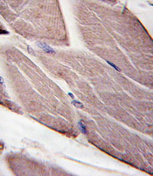 PDK4 Antibody in Immunohistochemistry (IHC)