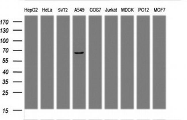 PDLIM5 Antibody in Western Blot (WB)