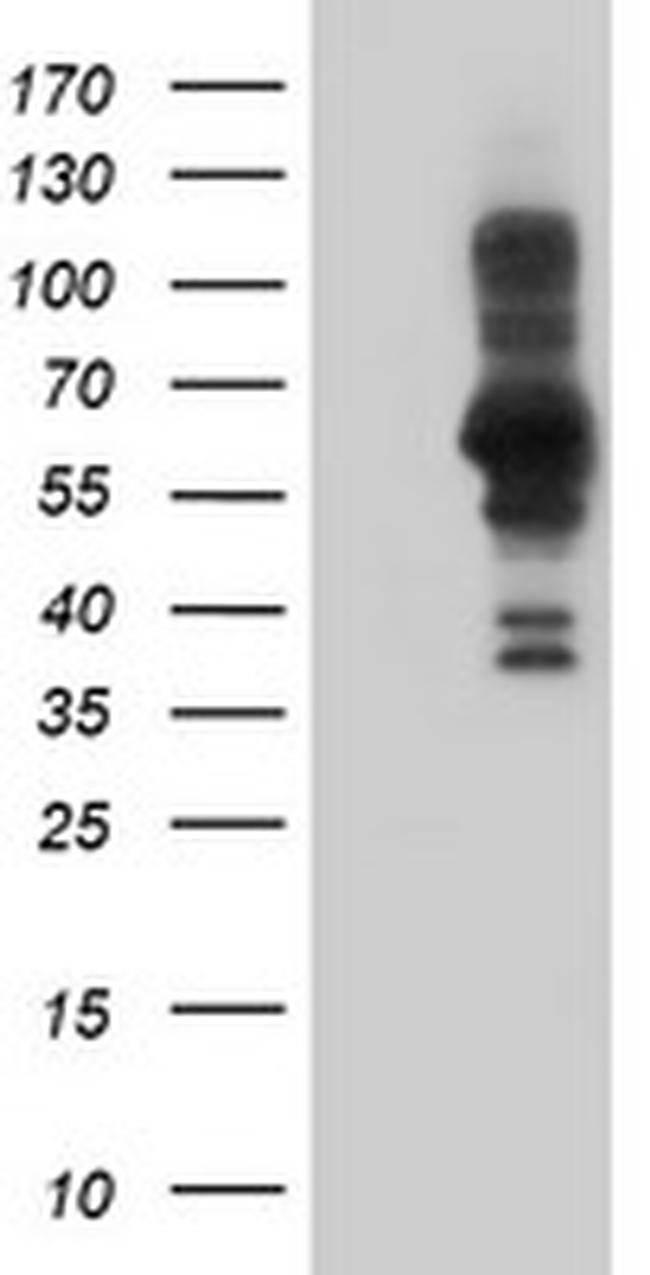 PDLIM5 Antibody in Western Blot (WB)