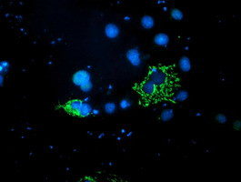 PDSS2 Antibody in Immunocytochemistry (ICC/IF)