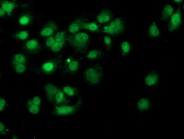 PDSS2 Antibody in Immunocytochemistry (ICC/IF)