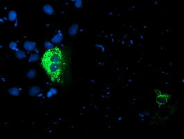 PDSS2 Antibody in Immunocytochemistry (ICC/IF)
