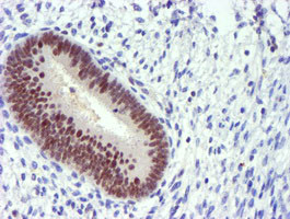 PDSS2 Antibody in Immunohistochemistry (Paraffin) (IHC (P))