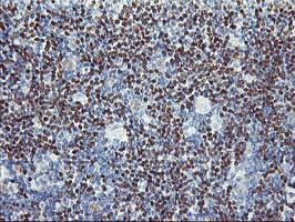 PDSS2 Antibody in Immunohistochemistry (Paraffin) (IHC (P))