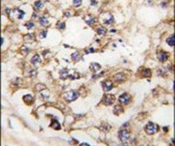 PDX1 Antibody in Immunohistochemistry (IHC)