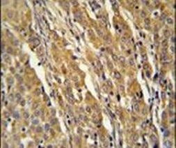 PDXDC1 Antibody in Immunohistochemistry (IHC)