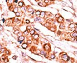 PDXK Antibody in Immunohistochemistry (IHC)