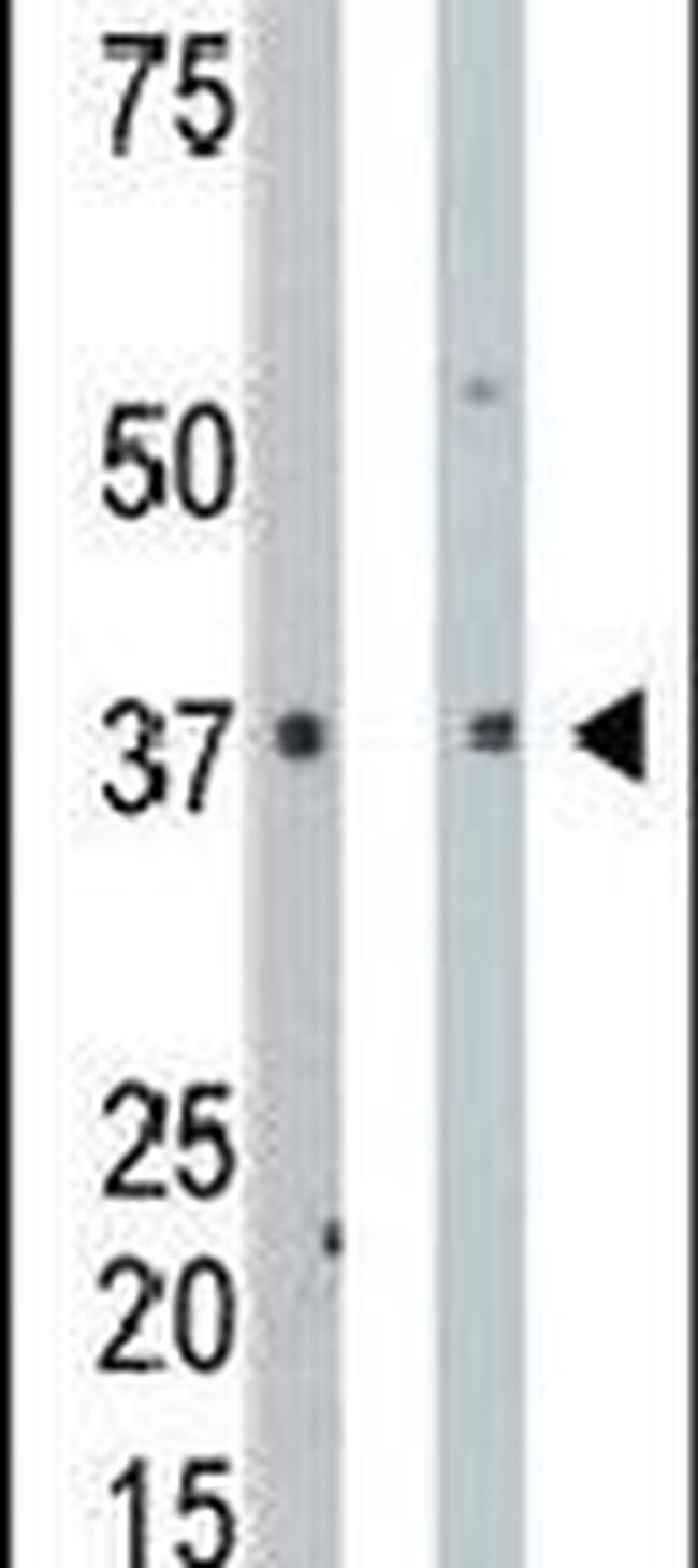 PDXK Antibody in Western Blot (WB)