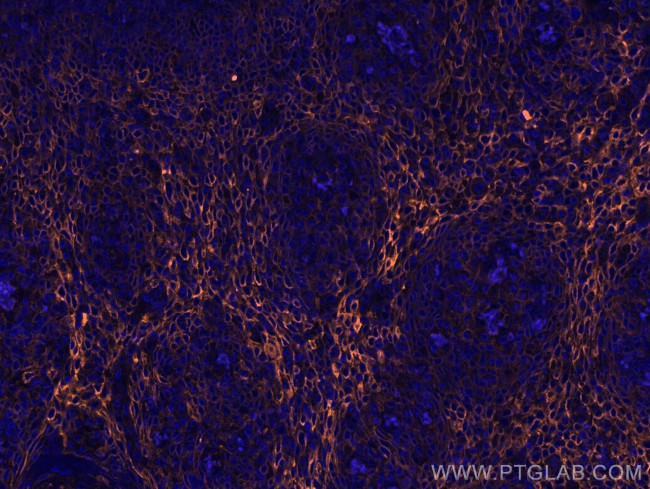 ICAM-1/CD54 Antibody in Immunohistochemistry (Paraffin) (IHC (P))