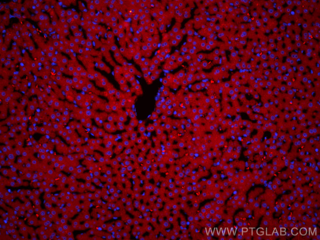 ASGR1 Antibody in Immunohistochemistry (Paraffin) (IHC (P))