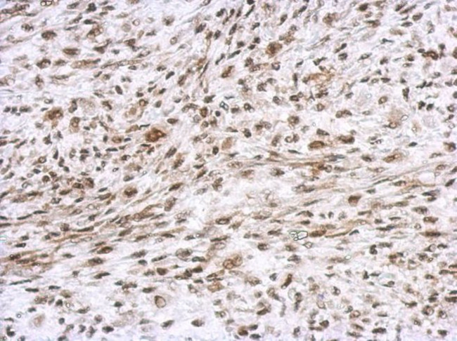 ETV4 Antibody in Immunohistochemistry (IHC)