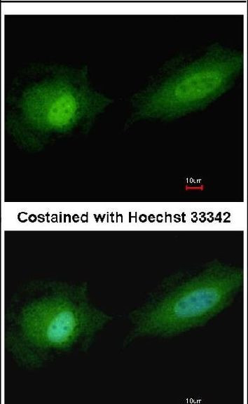 ETV4 Antibody in Immunocytochemistry (ICC/IF)