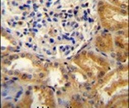 PEAR1 Antibody in Immunohistochemistry (IHC)