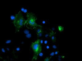 PECAM1 Antibody in Immunocytochemistry (ICC/IF)