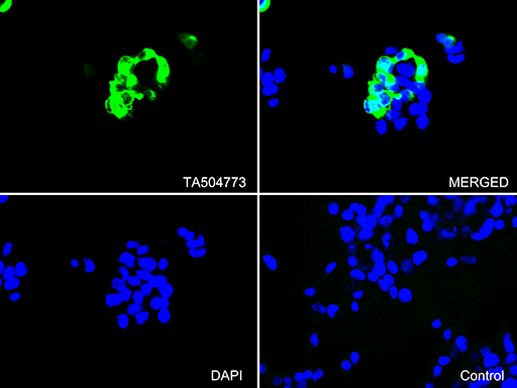 PECAM1 Antibody in Immunocytochemistry (ICC/IF)