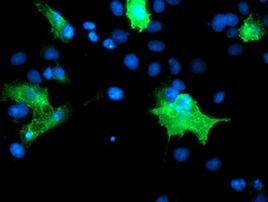 PECAM1 Antibody in Immunocytochemistry (ICC/IF)