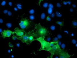 PECAM1 Antibody in Immunocytochemistry (ICC/IF)