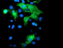 PECAM1 Antibody in Immunocytochemistry (ICC/IF)