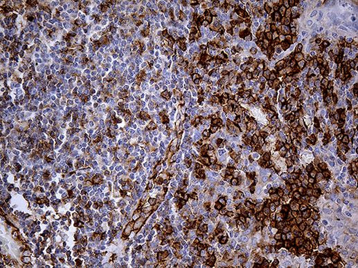 PECAM1 Antibody in Immunohistochemistry (Paraffin) (IHC (P))
