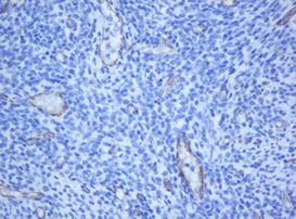 PECAM1 Antibody in Immunohistochemistry (Paraffin) (IHC (P))