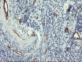 PECAM1 Antibody in Immunohistochemistry (Paraffin) (IHC (P))
