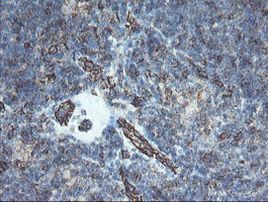 PECAM1 Antibody in Immunohistochemistry (Paraffin) (IHC (P))