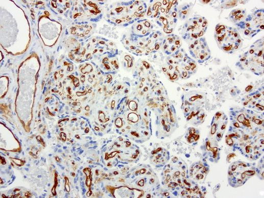 PECAM1 Antibody in Immunohistochemistry (Paraffin) (IHC (P))