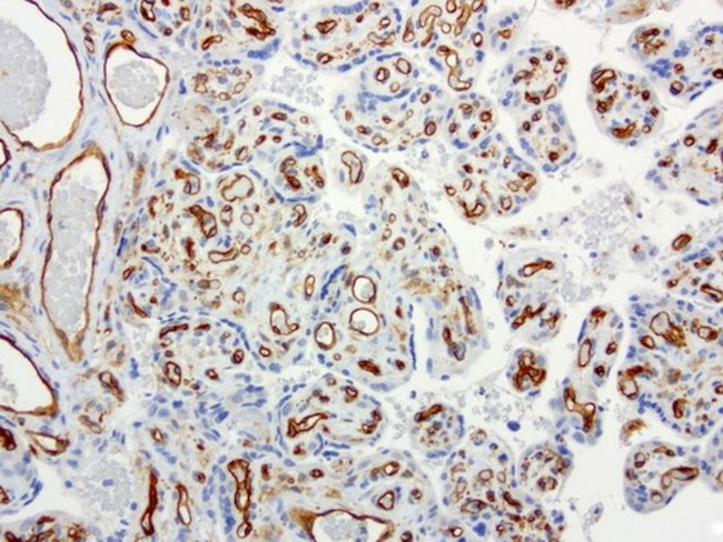 PECAM1 Antibody in Immunohistochemistry (Paraffin) (IHC (P))