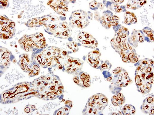 PECAM1 Antibody in Immunohistochemistry (Paraffin) (IHC (P))