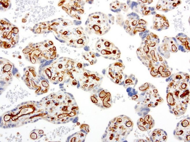 PECAM1 Antibody in Immunohistochemistry (Paraffin) (IHC (P))