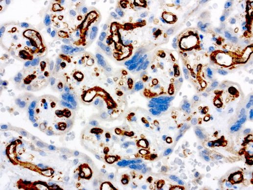 PECAM1 Antibody in Immunohistochemistry (Paraffin) (IHC (P))