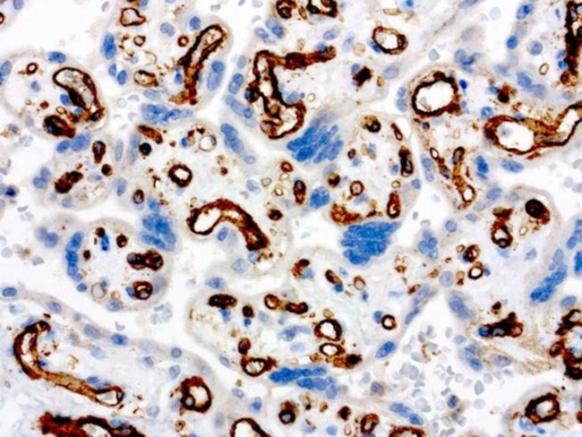 PECAM1 Antibody in Immunohistochemistry (Paraffin) (IHC (P))