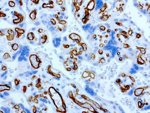 PECAM1 Antibody in Immunohistochemistry (Paraffin) (IHC (P))