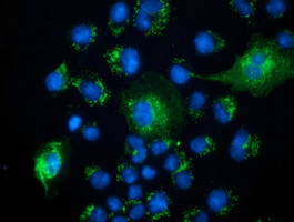 PECR Antibody in Immunocytochemistry (ICC/IF)