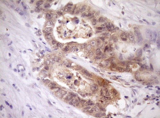 PELI1 Antibody in Immunohistochemistry (Paraffin) (IHC (P))