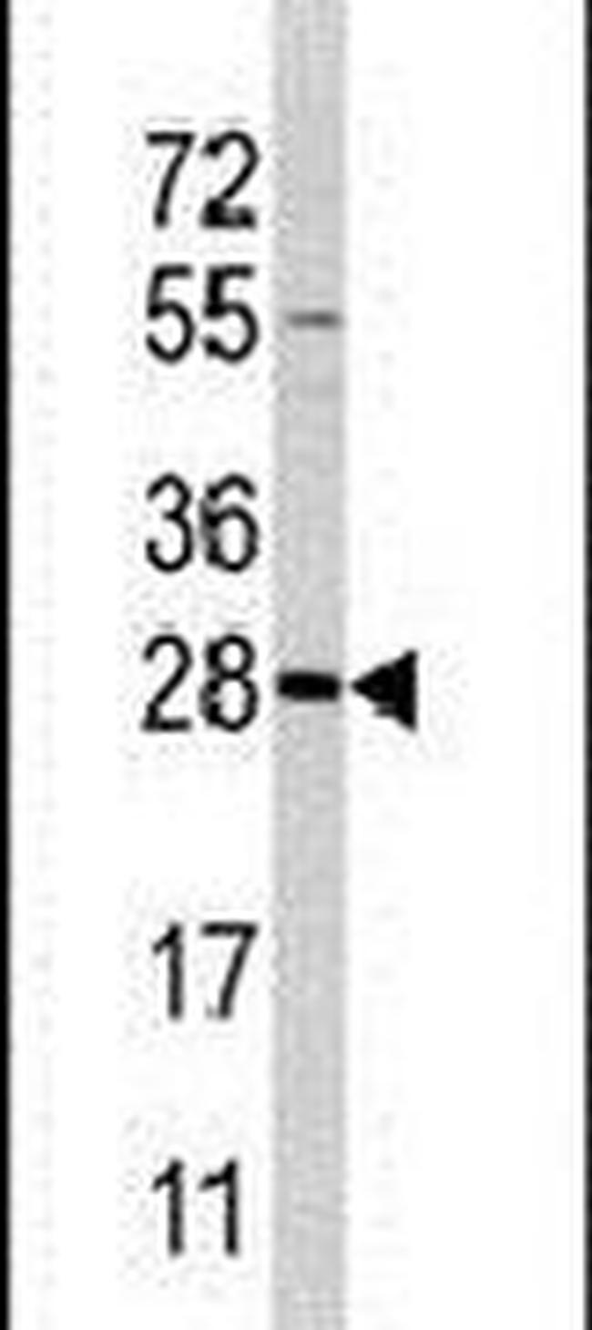 PEMT Antibody in Western Blot (WB)