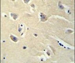 PENK Antibody in Immunohistochemistry (IHC)