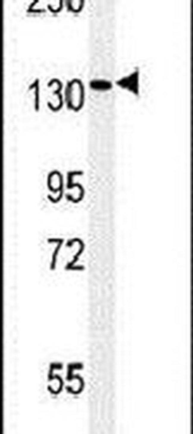 PEX1 Antibody in Western Blot (WB)