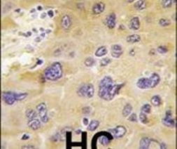 PFKFB1 Antibody in Immunohistochemistry (IHC)
