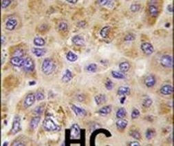 PFKFB1 Antibody in Immunohistochemistry (IHC)