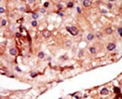 PFKFB2 Antibody in Immunohistochemistry (IHC)