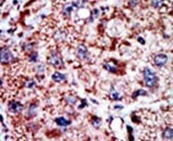 PFKL Antibody in Immunohistochemistry (IHC)