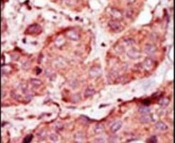 PFKP Antibody in Immunohistochemistry (IHC)