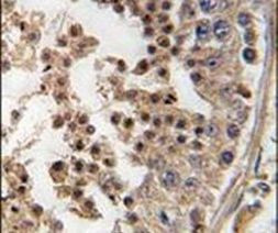 PFTK1 Antibody in Immunohistochemistry (IHC)