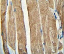 PGAM2 Antibody in Immunohistochemistry (IHC)