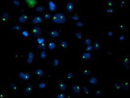 PGAM2 Antibody in Immunocytochemistry (ICC/IF)