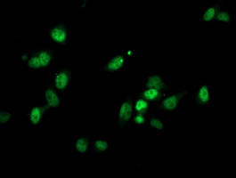 PGAM2 Antibody in Immunocytochemistry (ICC/IF)
