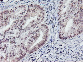 PGAM2 Antibody in Immunohistochemistry (Paraffin) (IHC (P))