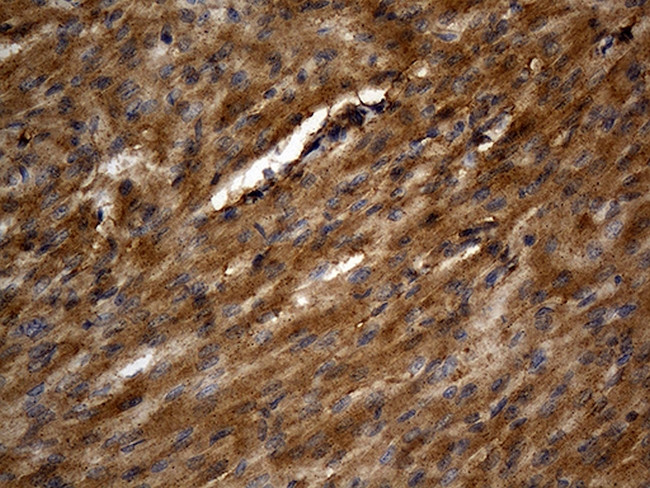 PGAM4 Antibody in Immunohistochemistry (Paraffin) (IHC (P))